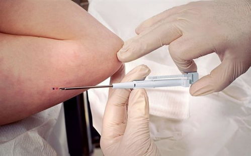 孕酮低胚胎發(fā)育一定差 孕酮低是偽命題 僅兩類孕媽要重點(diǎn)查它