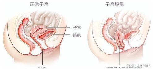 4月官宣三胎5月公布流產(chǎn),倍速太快被疑是她自導(dǎo)自演