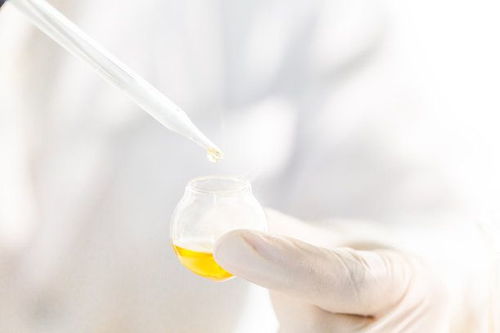 肥胖性生殖無能綜合癥是內分泌紊亂性疾病,有性腺發育異常的表現