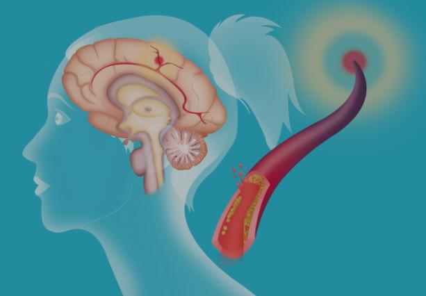 經常 手麻 的人要注意了 可能出現了這幾種問題,還請多注意