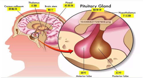 得了垂體瘤必須做手術嗎