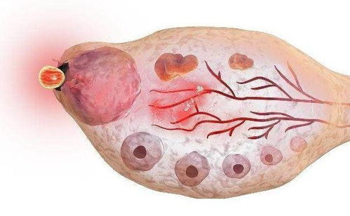 阿sa稱阿嬌長胖是因荷爾蒙失調,荷爾蒙失調對女性的影響有多大