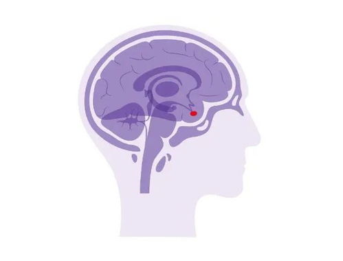 突然變胖變丑視力下降？警惕垂體瘤影響生殖激素