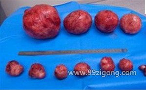 生殖系統(tǒng)與生殖激素