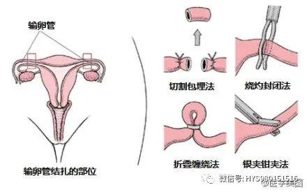 生殖激素 經典的醫學美圖解析