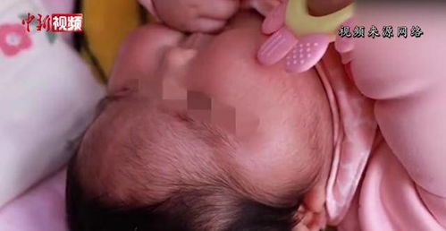 “嬰兒霜致大頭娃娃”事件進展 產品含生殖激素，涉案人員已被傳喚